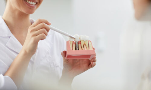 smiling-dentist-explaining-tooth-implantation