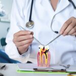 Dentist showing a model of a damaged tooth in need of dental filling upgrade