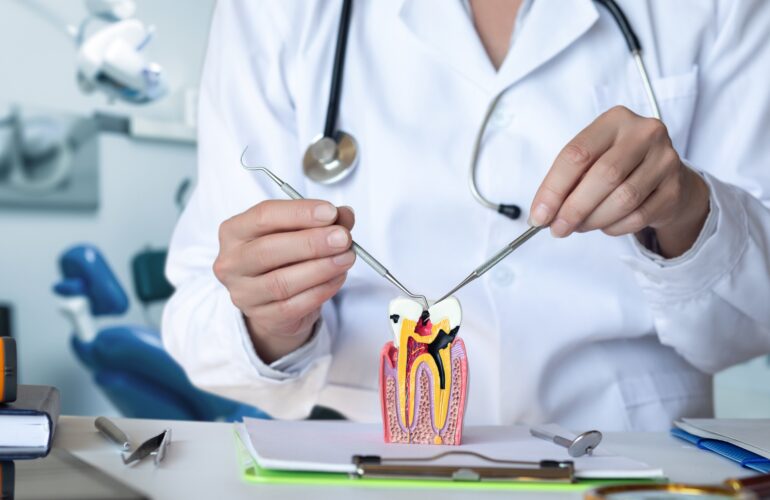 Dentist showing a model of a damaged tooth in need of dental filling upgrade