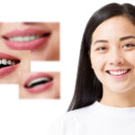 Patient with a successful smile makeover in Singapore