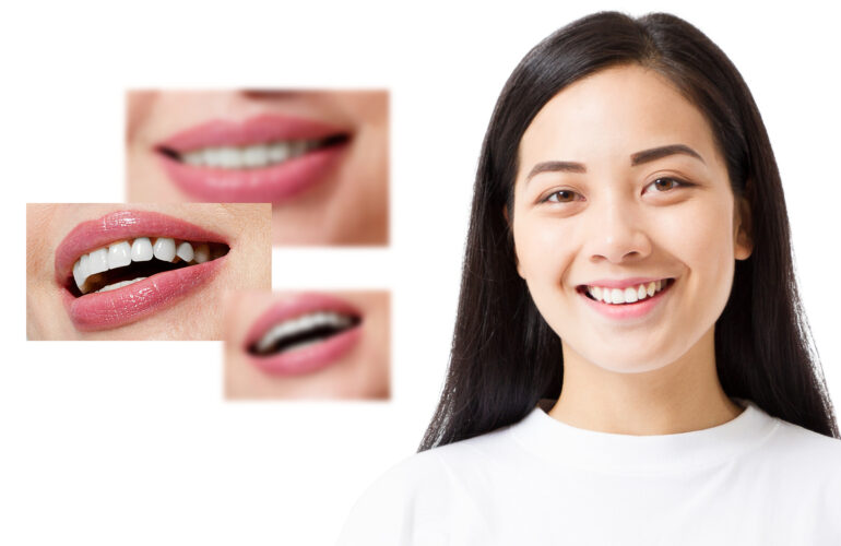 Patient with a successful smile makeover in Singapore