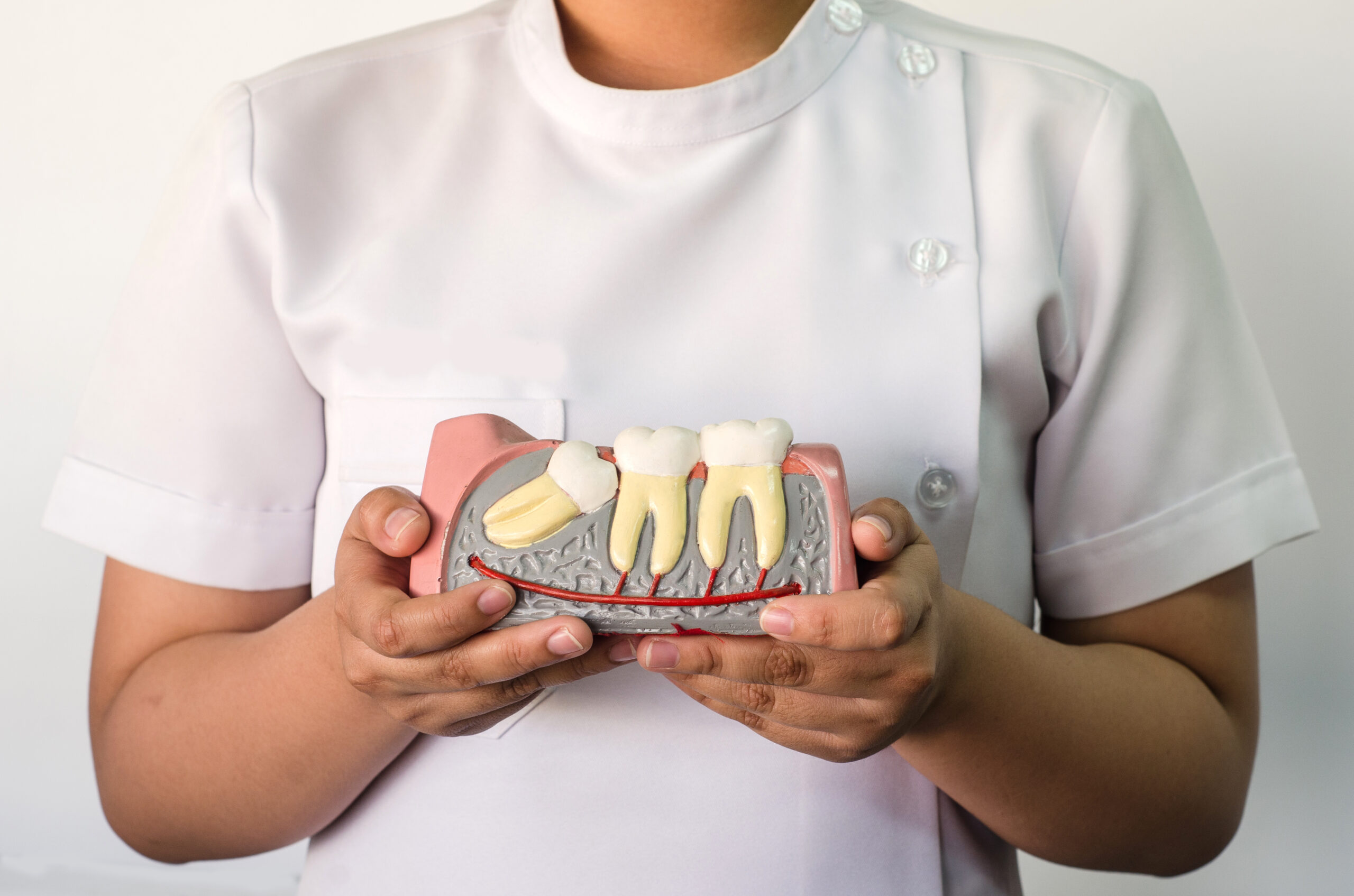 A dentist holding a wisdom teeth model during a consultation about wisdom tooth removal.