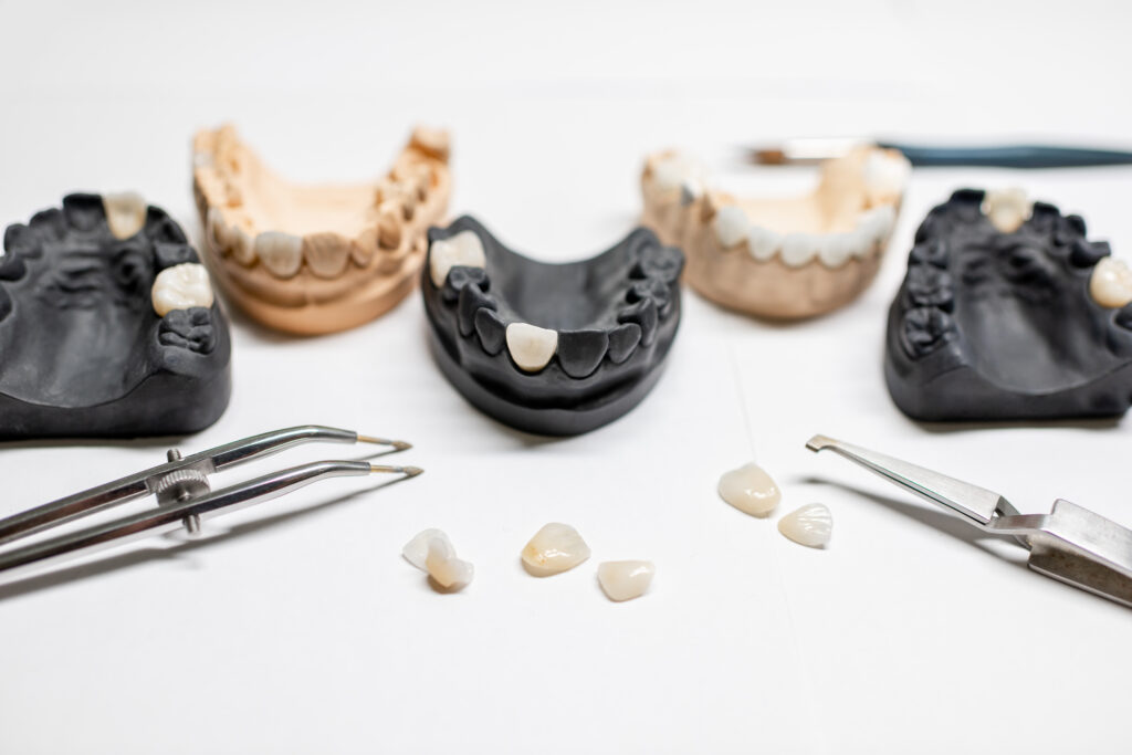 an image of a model dental crown placed in between model teeth
