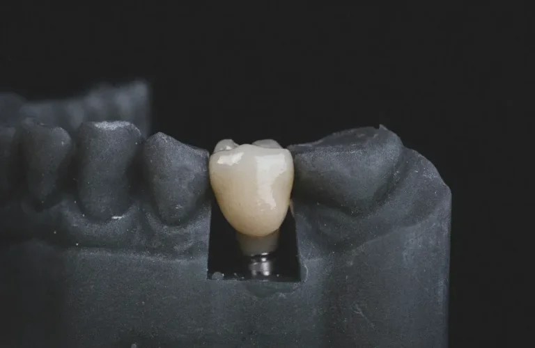 an image of a model dental crown placed in between model teeth