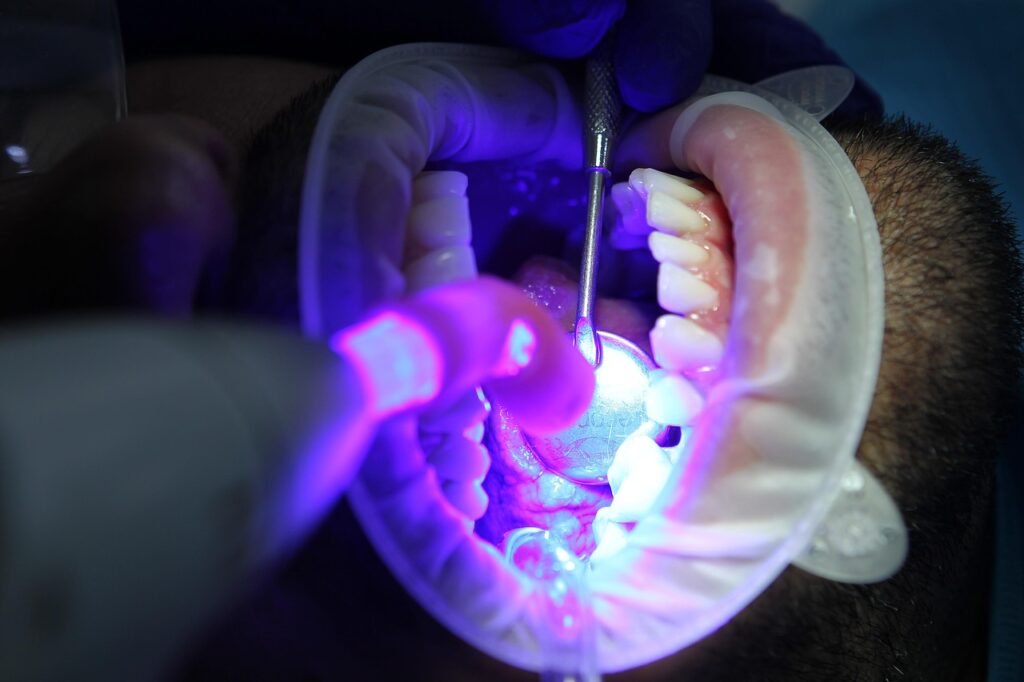 A patient undergoes teeth whitening, a cosmetic dentistry procedure, at a bukit timah dentist