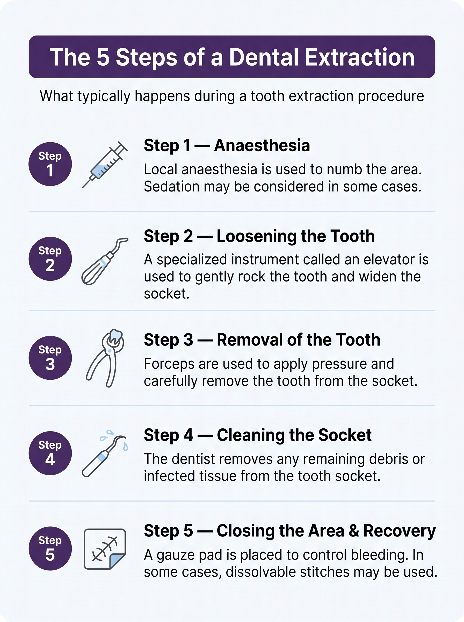 What to Expect Before, During, and After a Dental Extraction