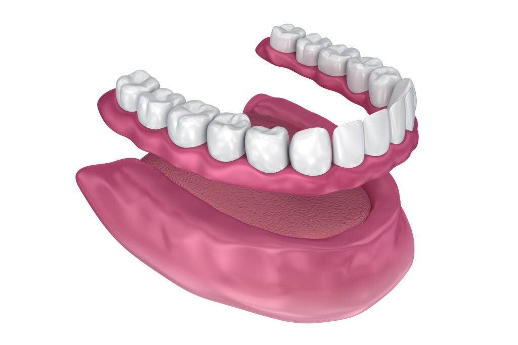 full removable dentures that attach to the patient through suction, a kind of tooth replacement option if the patient is missing all their teeth on one arch