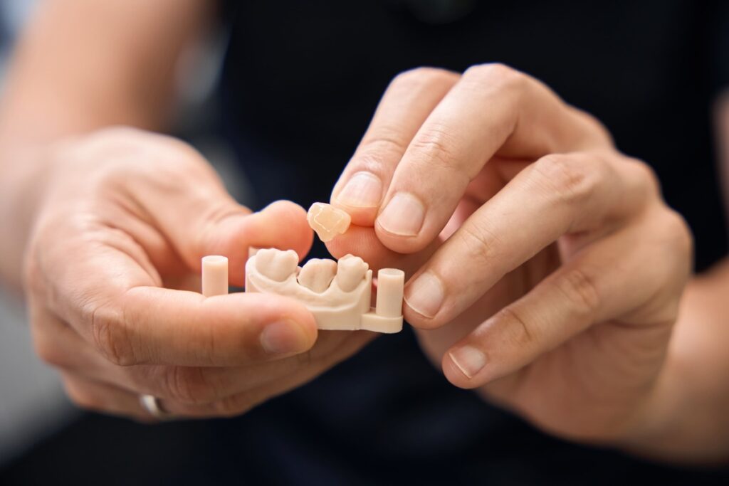 a dental professional holding a model of a dental crown in Singapore