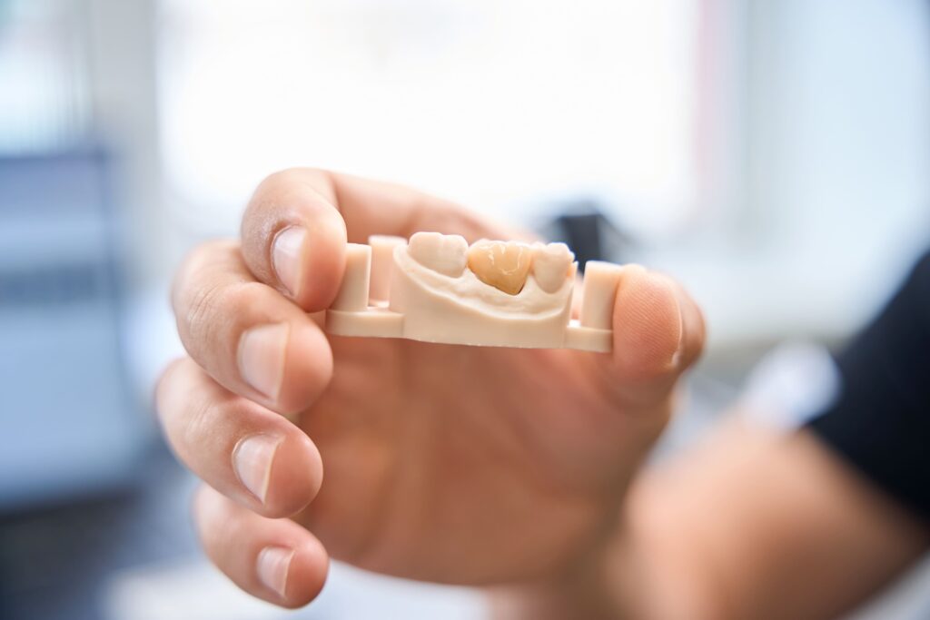 a dental professional holding a model of a bridge as a dental prosthesis example