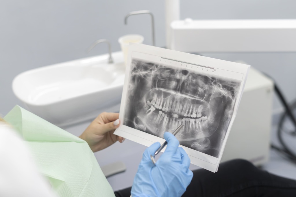 a dentist holding a tooth X-ray result as part of their teeth filling procedure in Singapore