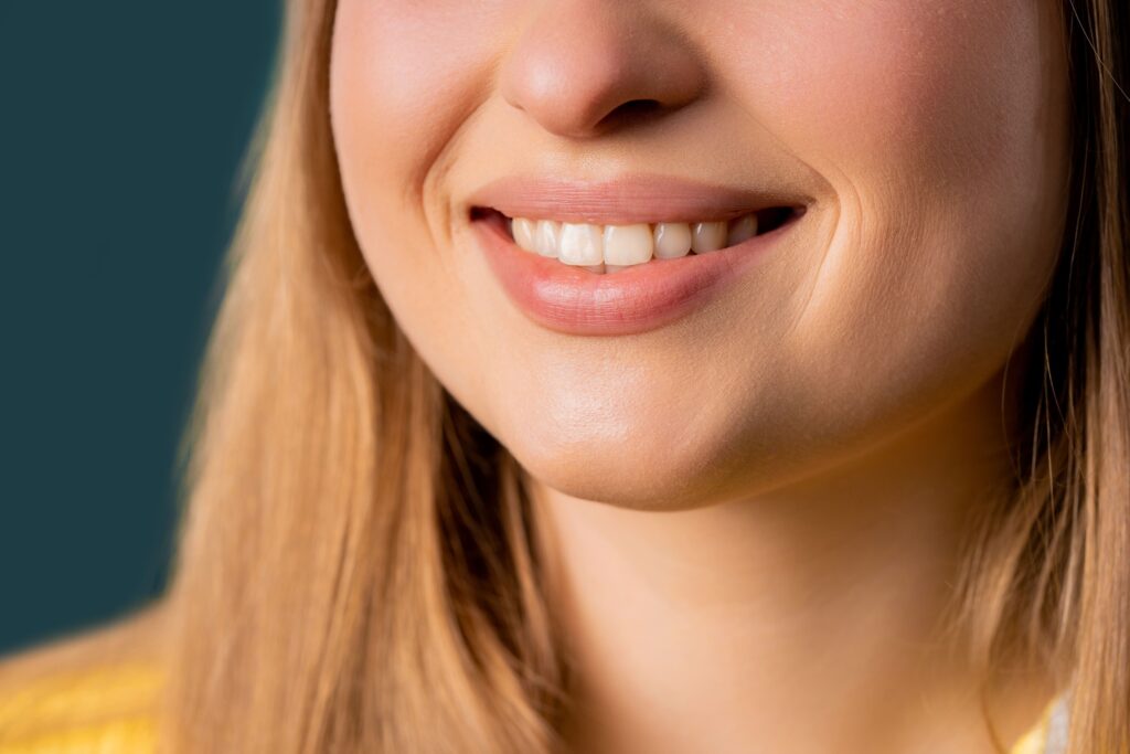 a woman smiling because of her smile makeover in Singapore